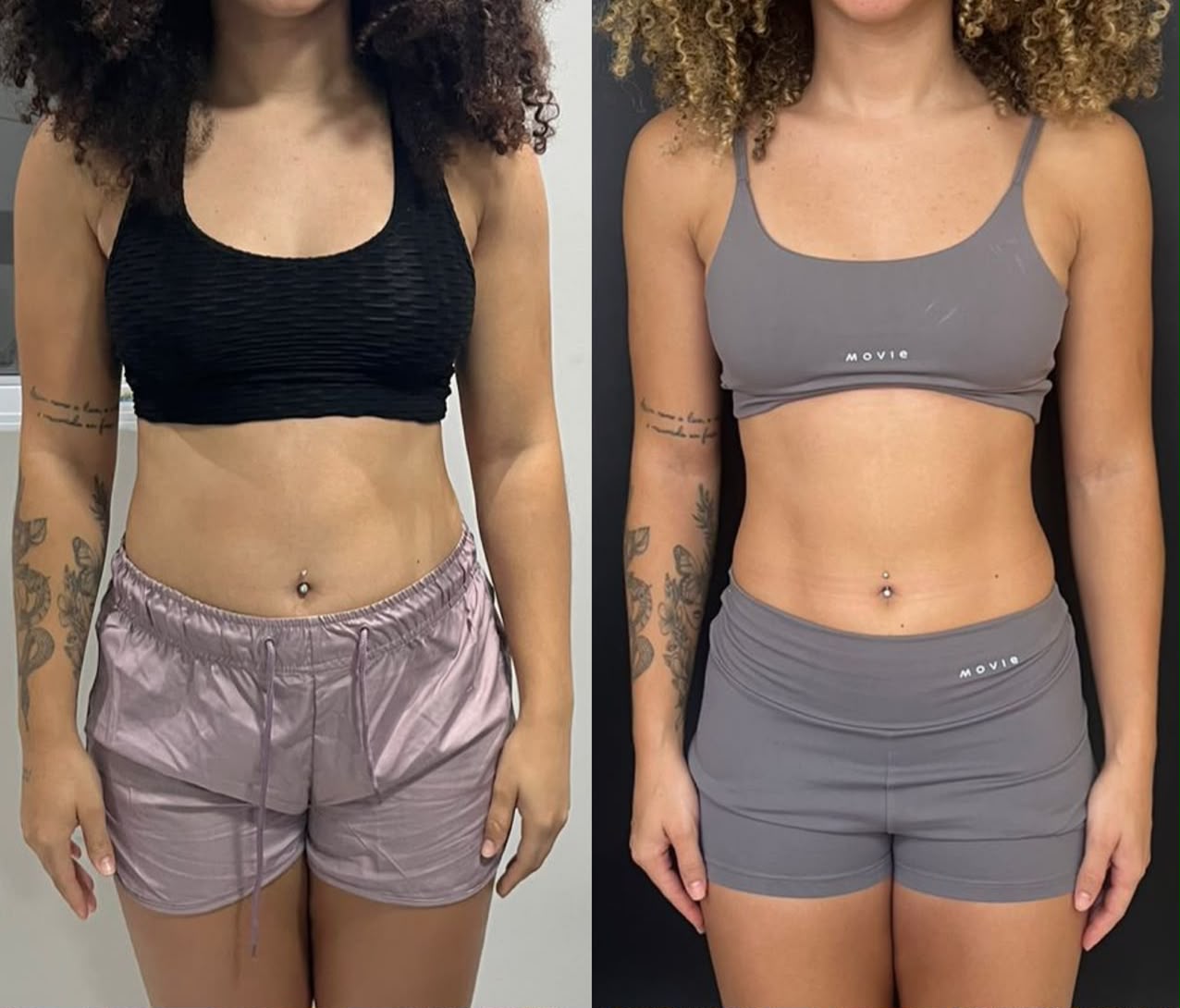 Registro de antes e depois de paciente em acompanhamento nutricional